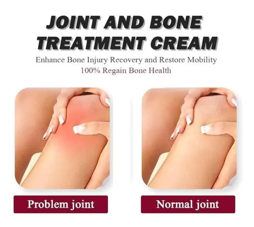 Perfectx Intensive Joint & Bone Therapy Cream (Pack of 2)